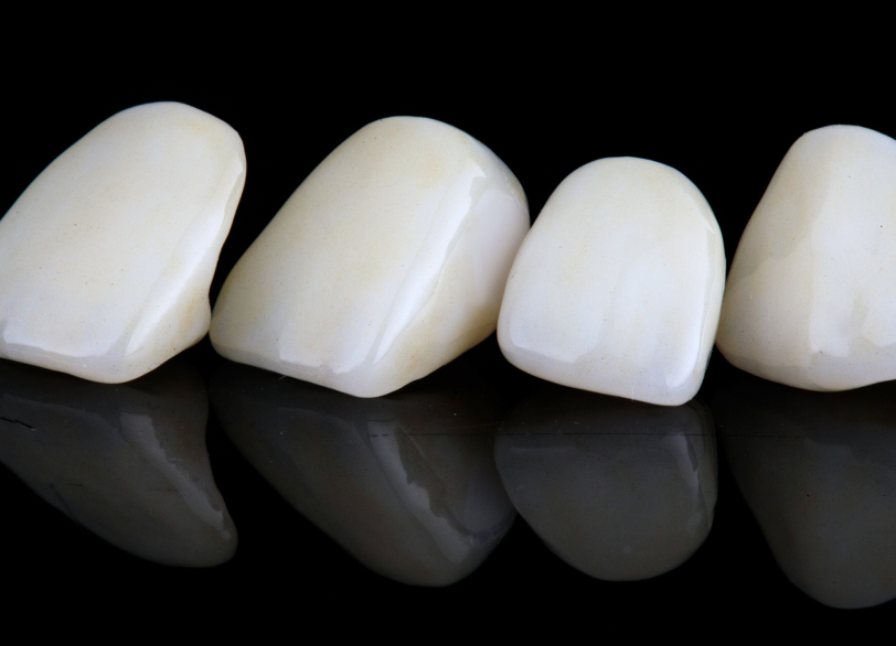 E-max|あおやま歯科