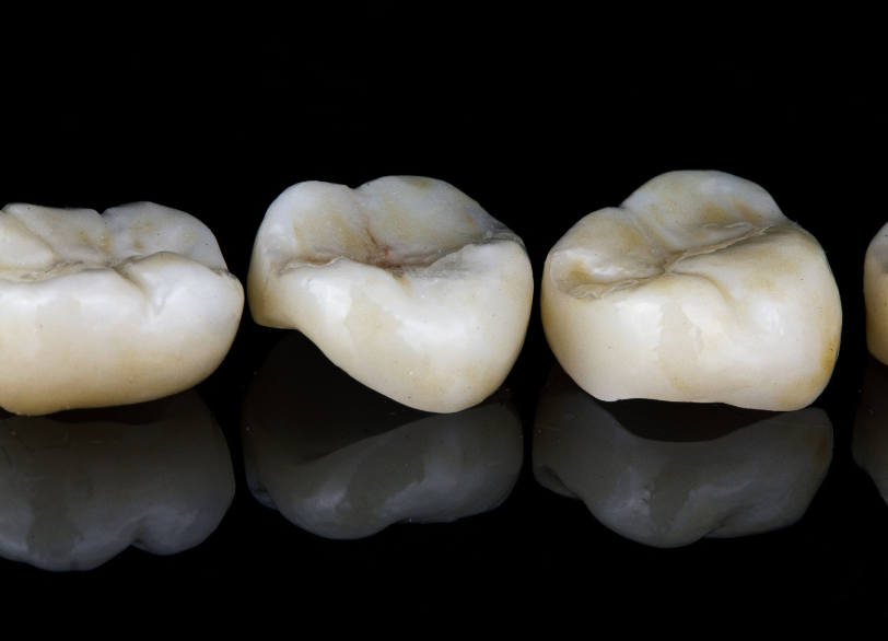 ジルコニア|あおやま歯科