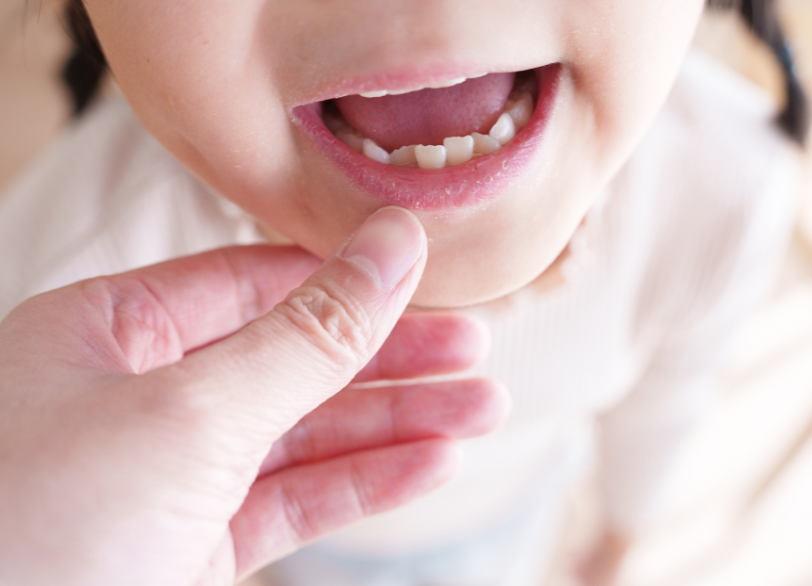 顎の健やかな成長を正しい方向へ導く|あおやま歯科