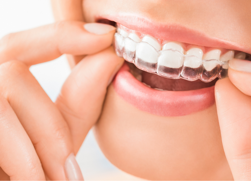 ライフスタイルに寄り添う矯正治療|あおやま歯科