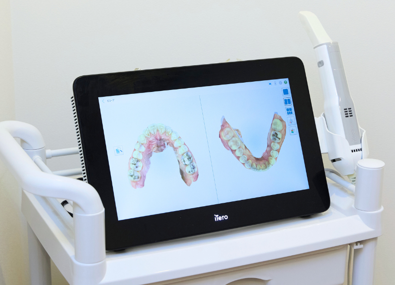 iTero|あおやま歯科