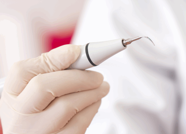 スケーリング|あおやま歯科