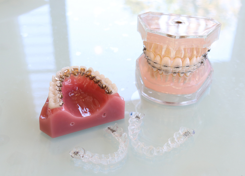 top9矯正治療の提案|あおやま歯科