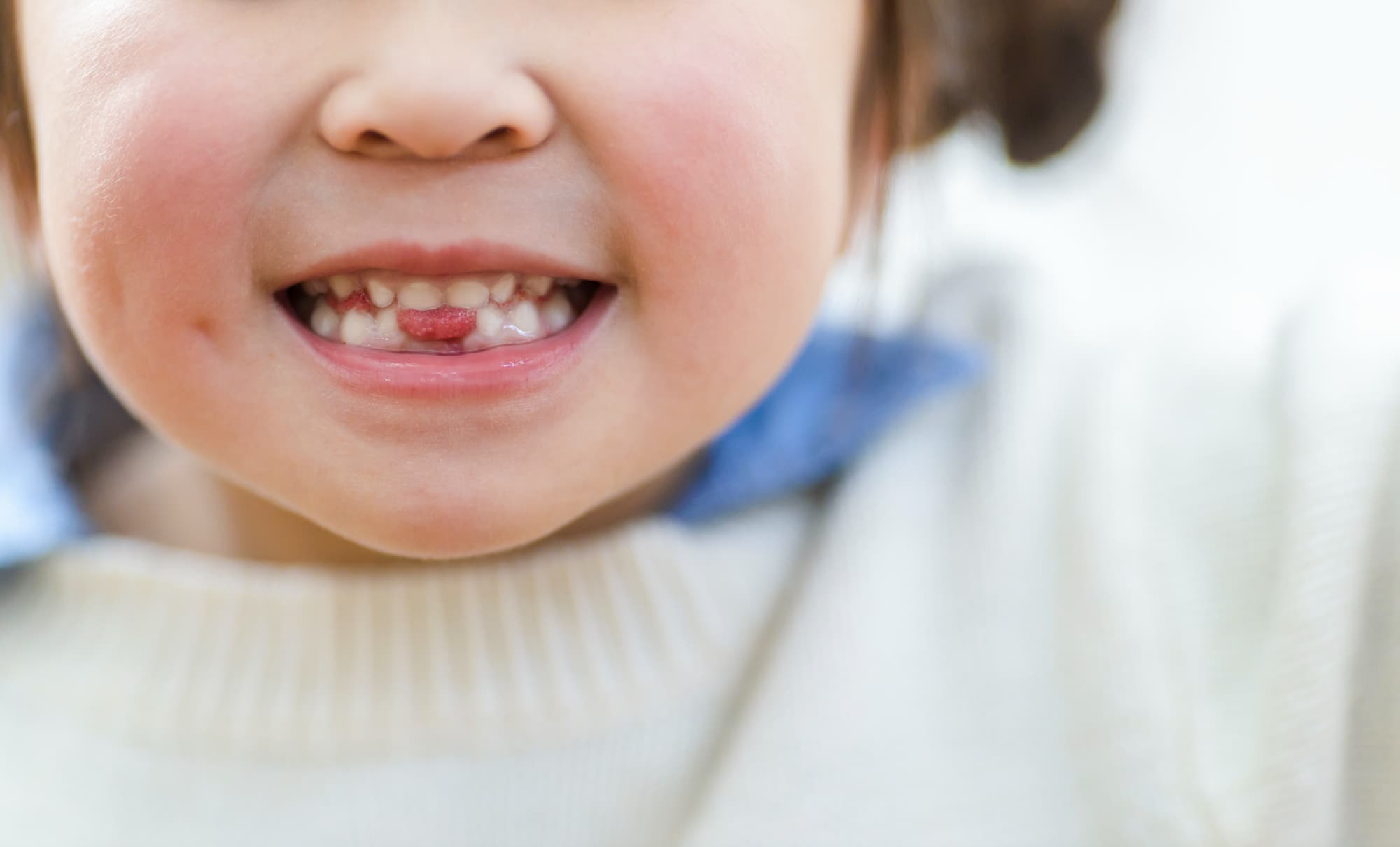 下の前歯が抜けた隙間から舌が出ている女の子の口元