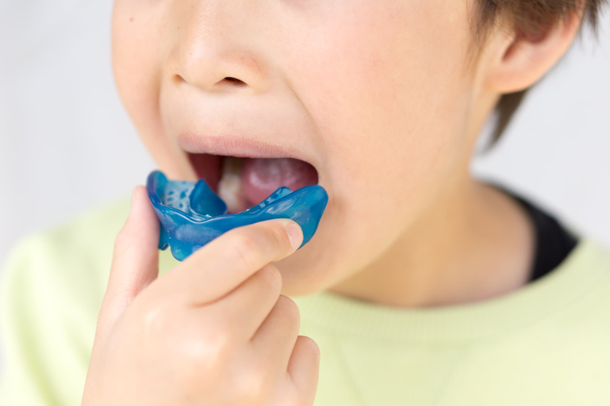 プレオルソを装着する様子