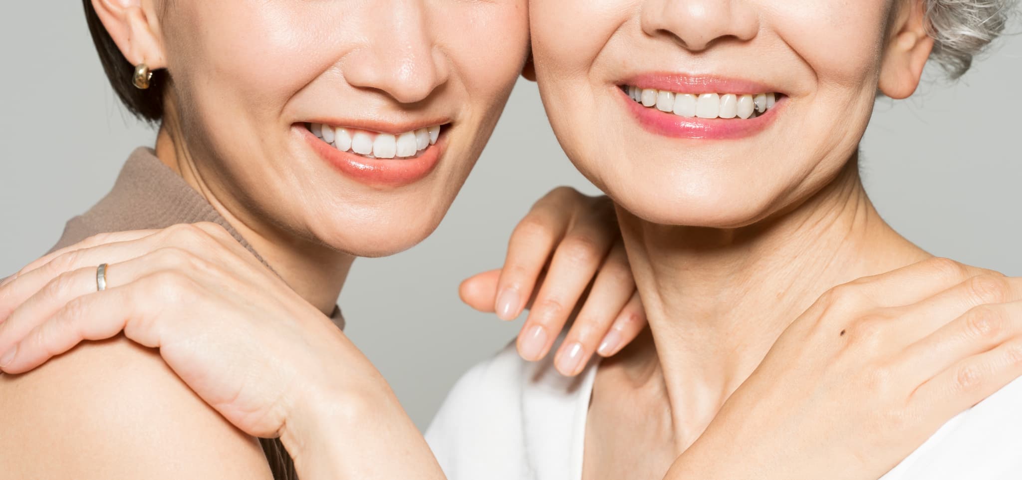 インプラント治療を受けた女性たち