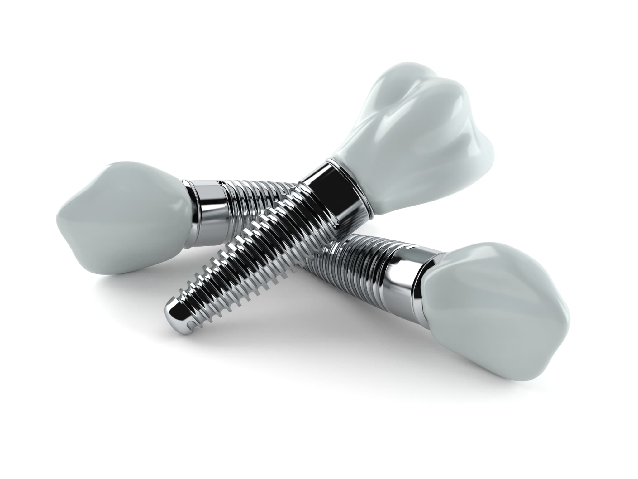 複数のインプラント