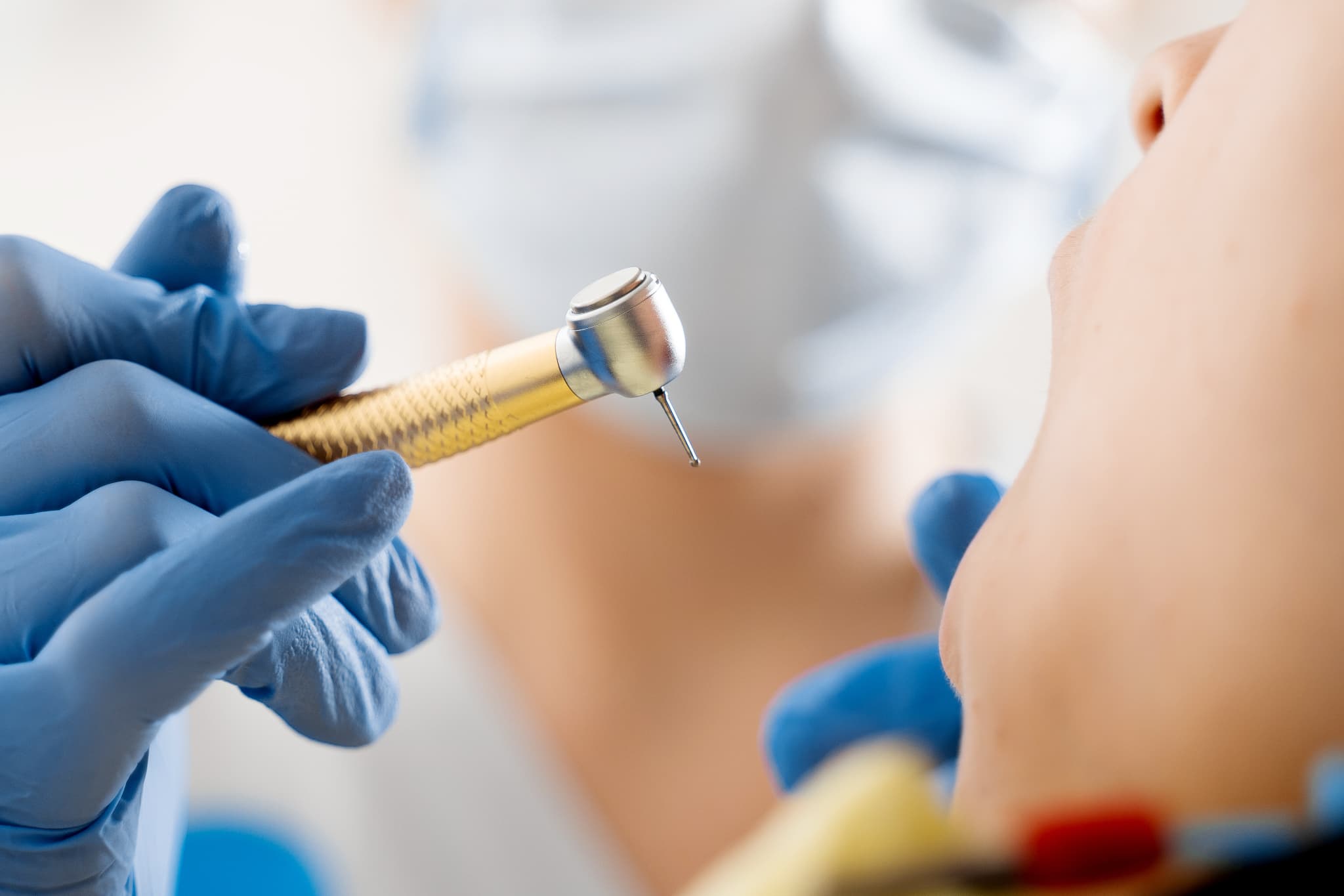 セラミックの歯にするために歯を削ずる様子