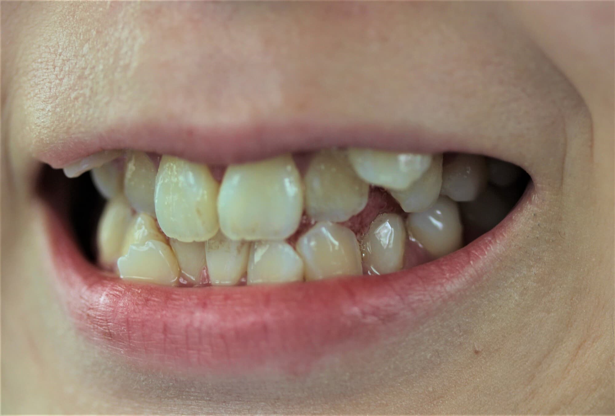 八重歯が見える口元